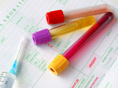 SEXUALITY:  Σε διάστημα έξι εβδομάδων φαίνεται αν έχω προσβληθεί από κάποιο ΣΜΝ;